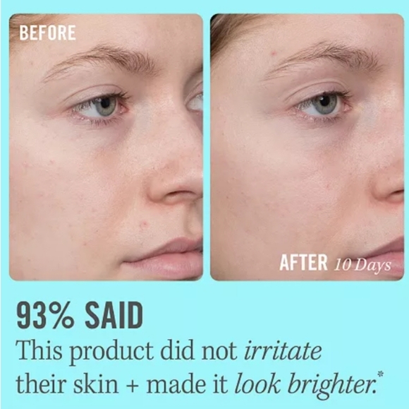 First Aid Beauty 10% Vitamin C Brightening Serum - Picture 11 of 12